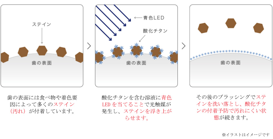 スマートホワイト